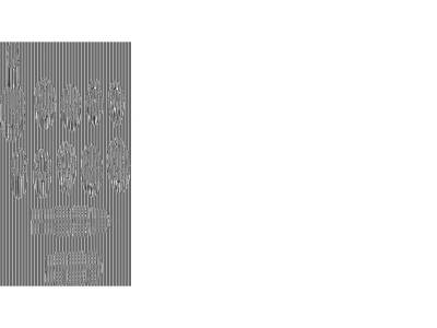 5 SPEED GEARSET 5-Speed Gear Set For Sportster Models