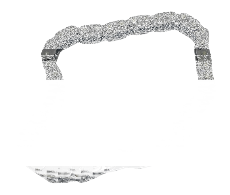 Twin Power Secondary Cam Chain TC06-17 (IT)