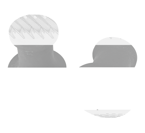 spacer cylinder bracket set 2 WL park (FR)
